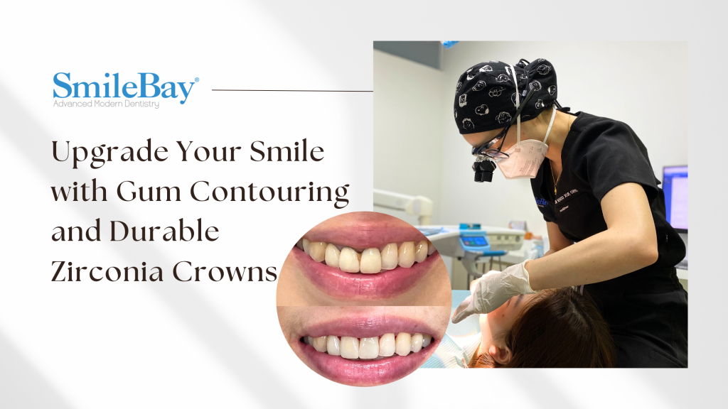 SmileBay dentist performing gum contouring and zirconia crowns treatment in Penang