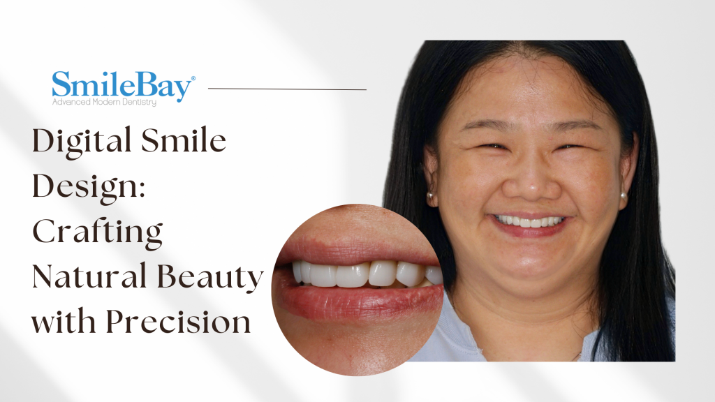 Patient smiling after Digital Smile Design treatment at SmileBay Dental Penang