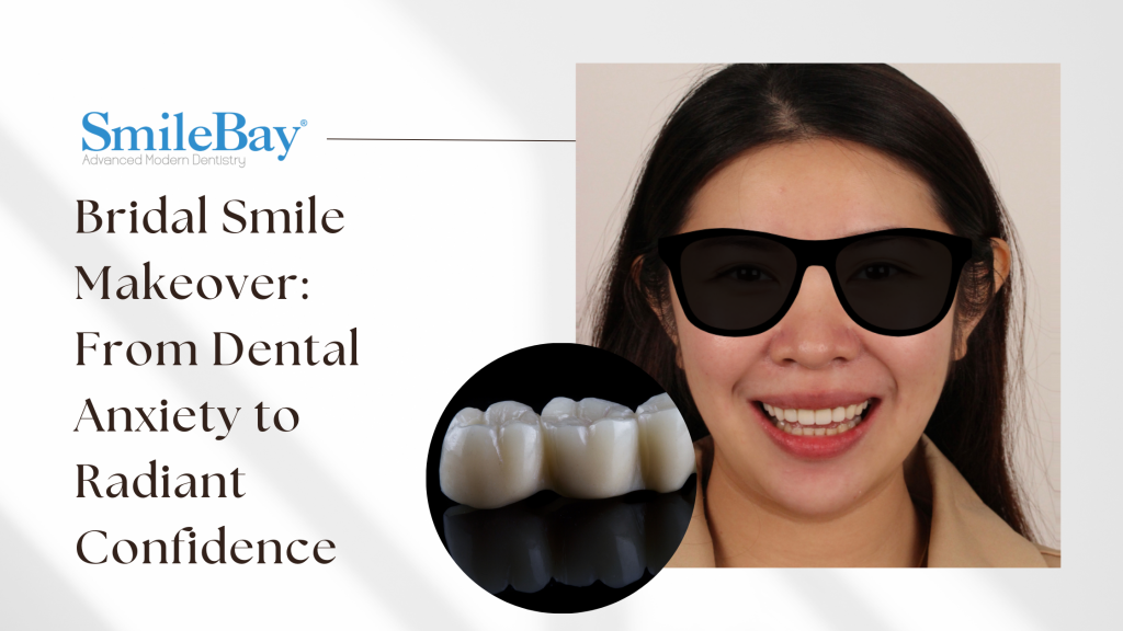 Bride smiling after smile makeover with dental crowns at SmileBay Dental Penang