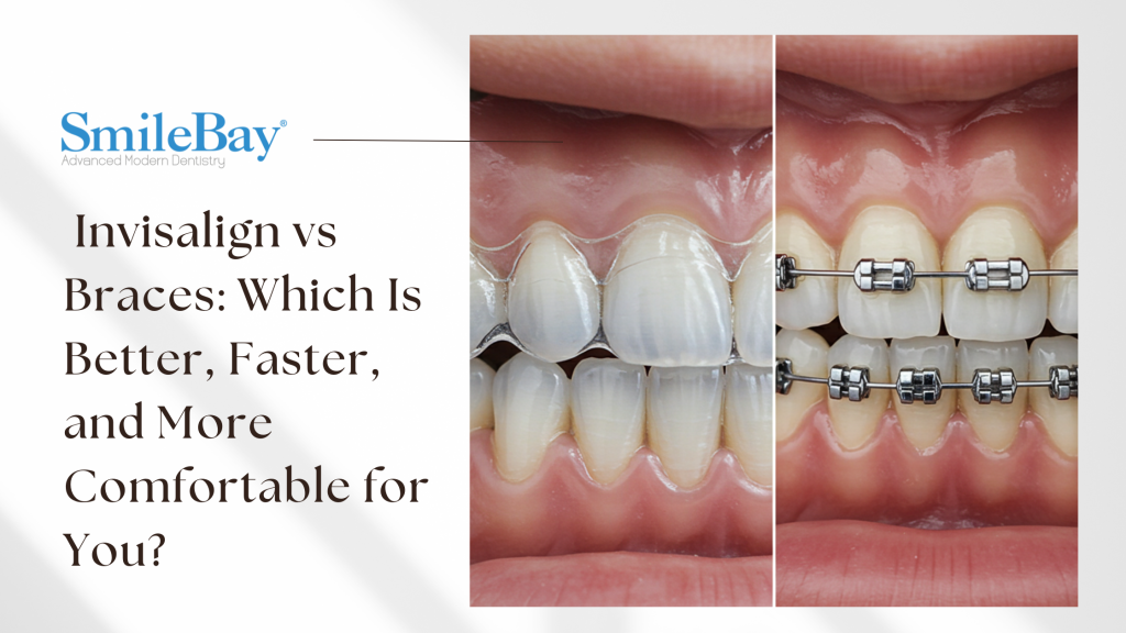 Comparison Invisalign vs braces