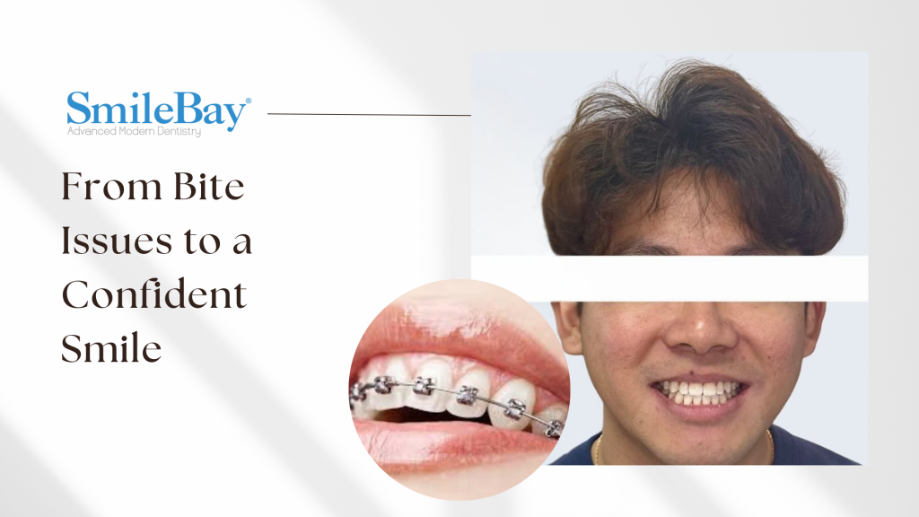 Blog header featuring a teen patient’s confident smile after orthodontic treatment and a close-up of braces, representing successful bite correction at SmileBay.